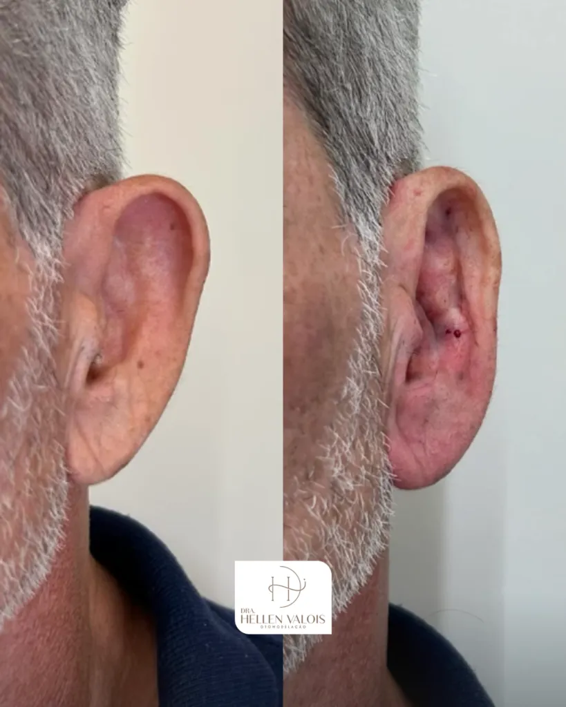 Correção estética