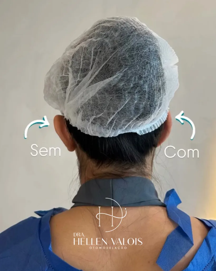 Mudança de estética