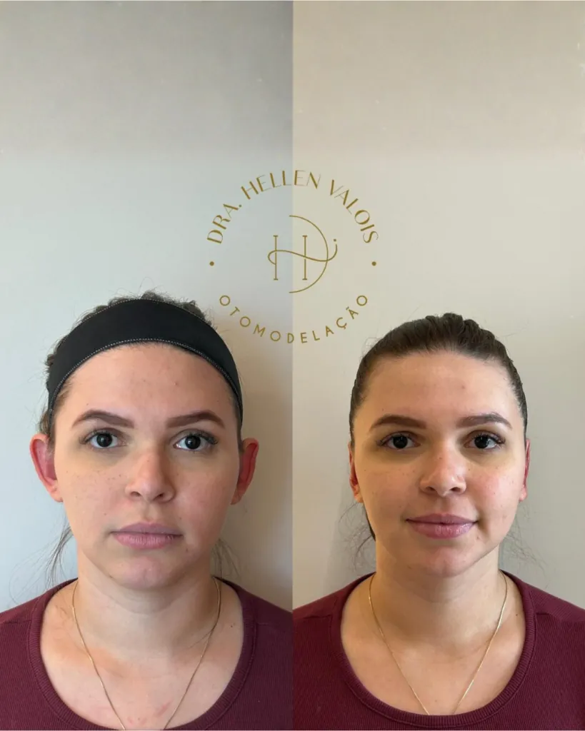 Resultado comparativo